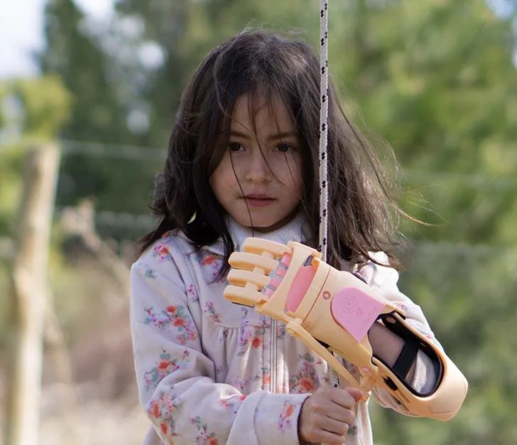 Una niña usa una prótesis 3D rosa mientras juega al aire libre