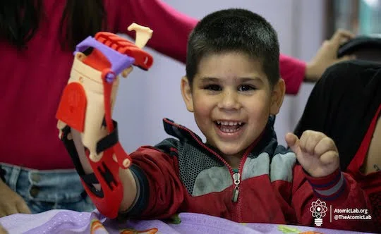 A child smiles with a red 3D-printed prosthesis