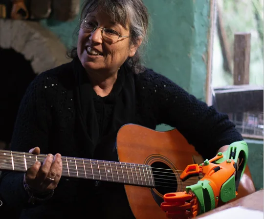 A woman plays the guitar using a 3D-printed prosthesis