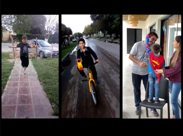 Three moments from a prosthesis delivery and its everyday use